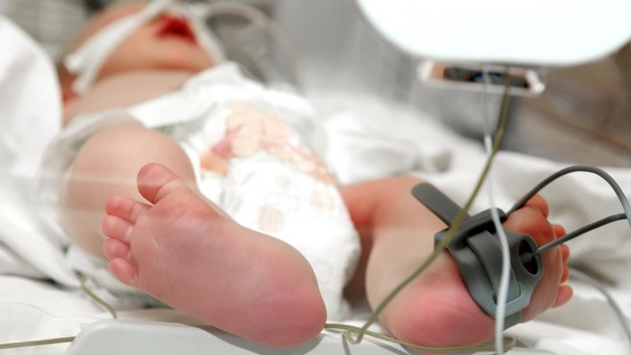 rianimazione neonatale in sala parto corso di aggiornamento al frangipane