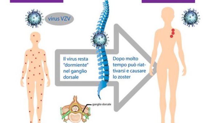 open day alla prevenzione dell infezione da herpes zoster via alle vaccinazioni