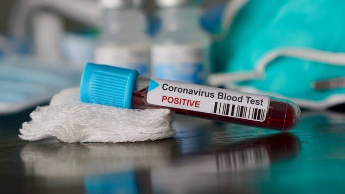 coronavirus caso positivo a mercato san severino