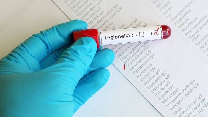 un caso di legionella a buonabitacolo infettata una donna